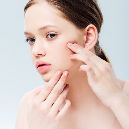 Young woman with acne-prone skin examining blemishes — ORY Skincare solutions for breakouts, redness, and congested pores.