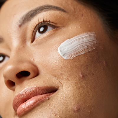 Close-up of a woman applying a smooth cream to her cheek, highlighting advanced emulsifier science in ORY Skincare formulations for balanced, hydrated skin.