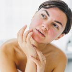 Woman with acne-prone skin applying soothing serum — ORY Skincare botanical serum for acne-prone complexions.